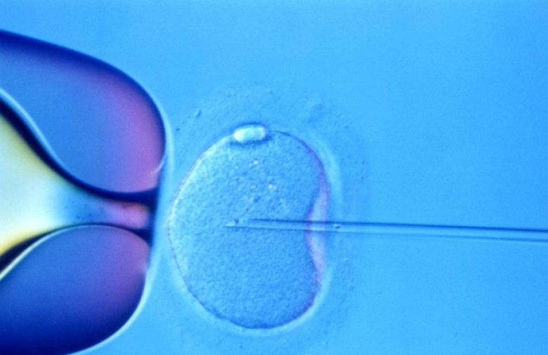 http://cdn.arstechnica.net/wp-content/uploads/2015/04/IVF587-640x415.jpg