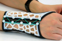 http://cdn.arstechnica.net/wp-content/uploads/2014/07/129-Wrist-Splint-640x426.jpg