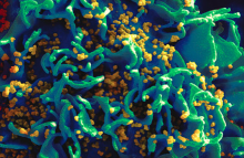 http://www.theverge.com/2014/7/10/5888187/hiv-virus-returns-in-child-thought-to-have-been-functionally-cured